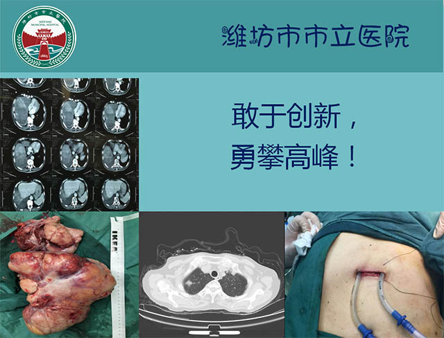 山東大學(xué)附屬山東省腫瘤醫(yī)院進(jìn)修總結(jié)暨胸部腫瘤治療新進(jìn)展報(bào)告